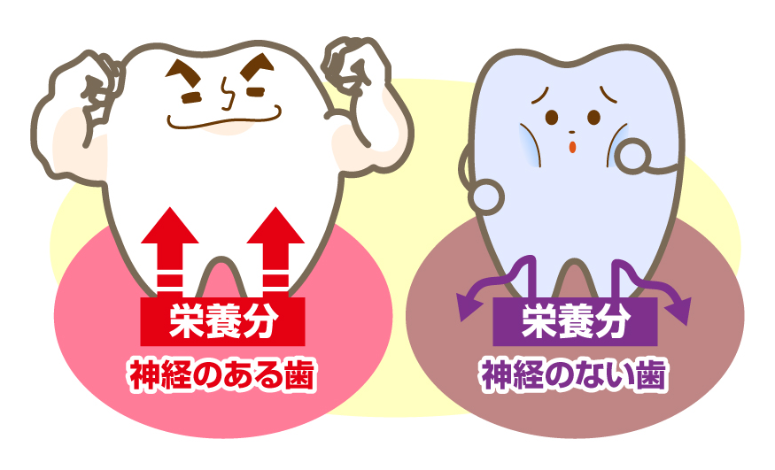 神経のある歯とない歯